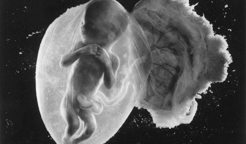 Foetus 18 Weeks © Lennart Nilsson Photography