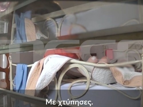 Σοκαριστικό βίντεο ντοκουμέντο από το μαρτύριο 84χρονης από την φροντίστριά της